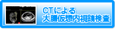 CTによる大腸仮想内視鏡検査