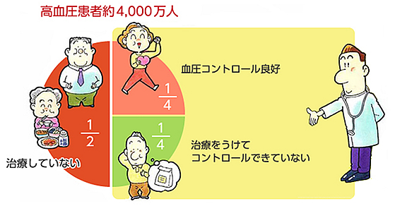 高血圧患者は4000万人！！