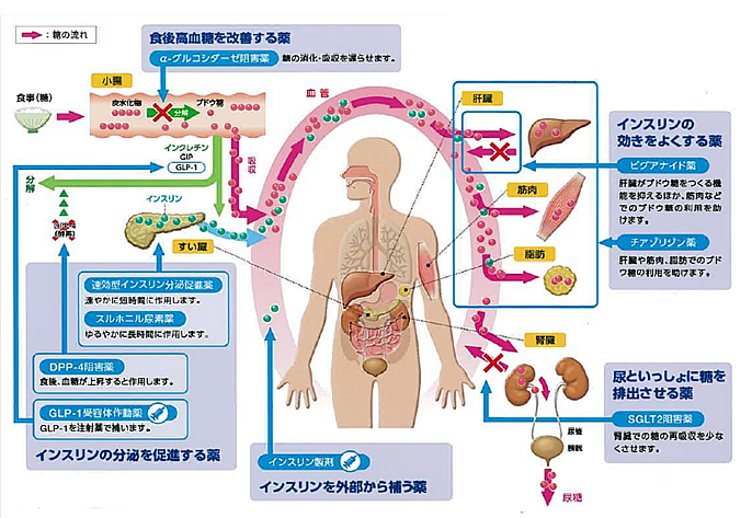 各種糖尿病薬の主な作用