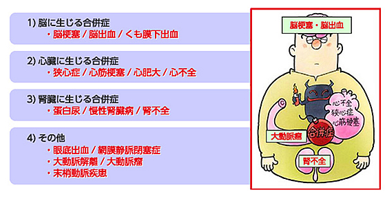 高血圧の合併症